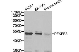 Western blot analysis of extracts of various cell lines, using PFKFB3 antibody (ABIN5974173) at 1/1000 dilution. (PFKFB3 antibody)