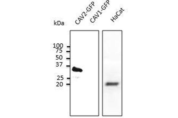 Caveolin 2 anticorps  (N-Term)