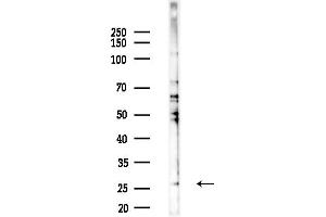 anti-Ubiquitin Domain Containing 2 (UBTD2) (C-Term) antibody