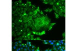 Immunofluorescence analysis of A549 cells using CACNG4 Polyclonal Antibody (CACNG4 antibody)