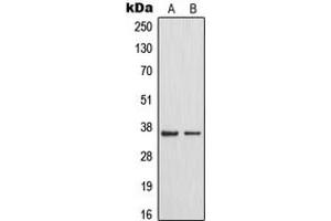 Western blot analysis of MAST4 expression in HeLa (A), HuvEc (B) whole cell lysates.
