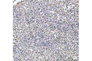 IHC analysis of ARID1A using anti-ARID1A antibody (ABIN7602567). (ARID1A antibody  (AA 857-1552))