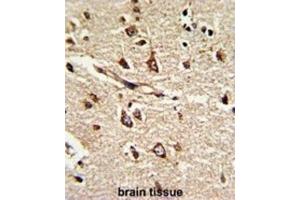 Immunohistochemistry (IHC) image for anti-Protein Disulfide Isomerase Family A, Member 6 (PDIA6) antibody (ABIN3002737) (PDIA6 antibody)