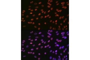 Immunofluorescence analysis of C6 cells using SMC1 Rabbit mAb (ABIN7270614) at dilution of 1:100 (40x lens). (SMC1A antibody)