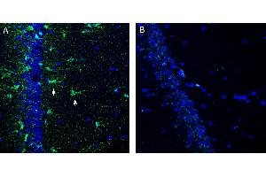 anti-Oligodendrocytic Myelin Paranodal and Inner Loop Protein (OPALIN) (AA 79-94), (C-Term), (Intracellular) antibody