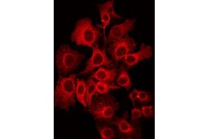 ABIN6272392 staining NIH-3T3 by IF/ICC. (PIPOX antibody  (Internal Region))