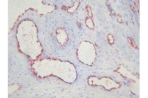 Immunohistochemistry (IHC) image for anti-Endothelial Cells antibody (ABIN781798) (Endothelial Cells antibody)