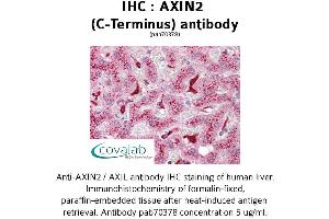 Image no. 1 for anti-Axin 2 (AXIN2) antibody (ABIN1732157) (AXIN2 antibody)