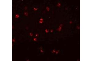Immunofluorescencent staining of Jurkat cells with NLRC3 polyclonal antibody  at 20 ug/mL.