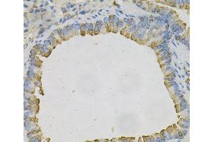 Immunohistochemistry of paraffin-embedded Mouse lung using AZGP1 Polyclonal Antibody at dilution of 1:100 (40x lens). (AZGP1 antibody)