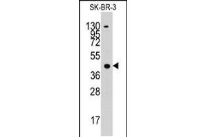 Western blot analysis of anti-ACAT1 Pab in SK-BR-3 cell line lysates (35ug/lane) (ACAT1 antibody  (C-Term))