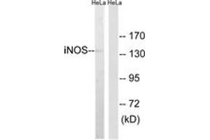 Western blot analysis of extracts from HeLa cells, using iNOS Antibody. (NOS2 antibody  (AA 1101-1150))