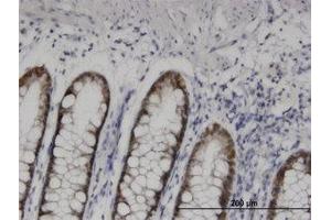 Image no. 1 for anti-Homeobox D11 (HOXD11) (AA 1-77) antibody (ABIN599383) (HOXD11 antibody  (AA 1-77))