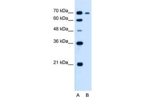 Western Blotting (WB) image for anti-Ribonucleotide Reductase M1 (RRM1) antibody (ABIN2462920) (RRM1 antibody)