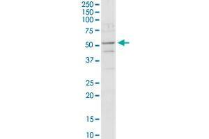 ACADM MaxPab rabbit polyclonal antibody. (Medium-Chain Specific Acyl-CoA Dehydrogenase, Mitochondrial (MCAD) (AA 1-421) antibody)