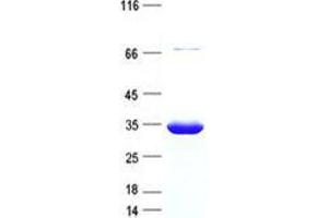Validation with Western Blot (CCDC122 Protein (Coiled coil domain) (His tag))