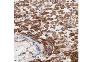 Immunohistochemistry of paraffin-embedded human placenta tissue slide using ABIN7095788 (MEG3 Antibody) at dilution of 1:50 (MEG3 antibody)