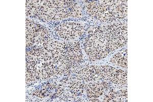 IHC analysis of SNRNP200 using anti-SNRNP200 antibody (ABIN7602032). (SNRNP200 antibody  (AA 557-2129))