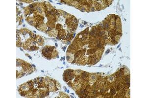 Immunohistochemistry of paraffin-embedded Human stomach using CETP Polyclonal Antibody (CETP antibody)