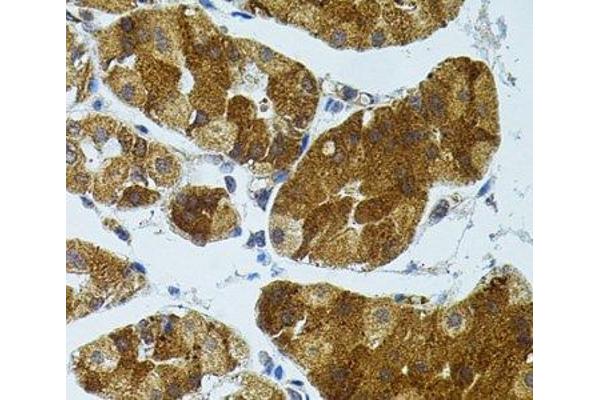 CETP antibody