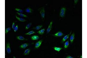 Immunofluorescent analysis of Hela cells using ABIN7152313 at dilution of 1:100 and Alexa Fluor 488-congugated AffiniPure Goat Anti-Rabbit IgG(H+L) (EXTL3 antibody  (AA 2-245))