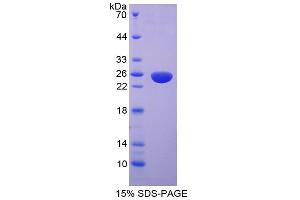 Image no. 1 for Myosin Light Chain Kinase 2 (MYLK2) (AA 327-536) protein (His tag) (ABIN4989828)