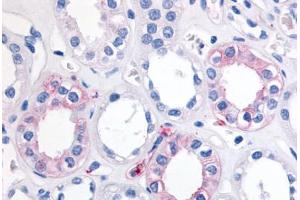 Human Kidney (formalin-fixed, paraffin-embedded) stained with EPHX2 antibody ABIN290080 at 20 ug/ml followed by biotinylated goat anti-rabbit IgG secondary antibody ABIN481713, alkaline phosphatase-streptavidin and chromogen. (EPHX2 antibody  (Internal Region))