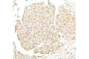 anti-DDB1 and CUL4 Associated Factor 6 (DCAF6) (AA 300-350) antibody