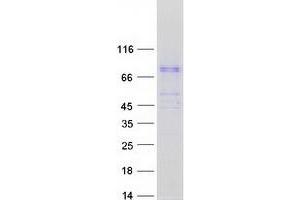 Validation with Western Blot (BBS7 Protein (Transcript Variant 2) (Myc-DYKDDDDK Tag))