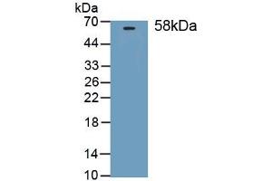 Detection of Recombinant THBS3, Mouse using Polyclonal Antibody to Thrombospondin 3 (THBS3)
