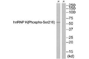 Western blot analysis of extracts from JurKat cells, using hnRNP K (Phospho-Ser216) antibody. (HNRNPK antibody  (pSer216))