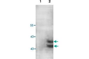 Western blot analysis of human fetal muscle lysate with PARP11 polyclonal antibody  at 1 : 200 dilution. (PARP11 antibody  (C-Term))