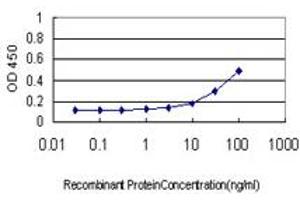 Detection limit for recombinant GST tagged SOCS6 is approximately 1ng/ml as a capture antibody. (SOCS6 antibody  (AA 1-535))