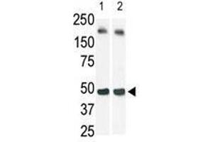 The anti-SphK1 Pab is used in Western blot (Lane 2) to detect c-myc-tagged SphK1 in transfected 293 cell lysate (a c-myc antibody is used as control in Lane 1). (SPHK1 antibody  (N-Term))