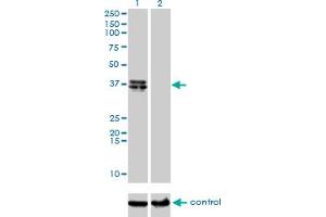 Western blot analysis of B4GALT4 over-expressed 293 cell line, cotransfected with B4GALT4 Validated Chimera RNAi (Lane 2) or non-transfected control (Lane 1). (B4GALT4 antibody  (AA 35-134))