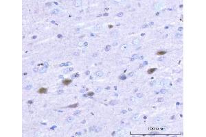 IHC analysis of Adgrg1 using anti-Adgrg1 antibody (ABIN7601979). (Adhesion G Protein-Coupled Receptor G1 (ADGRG1) (AA 53-554) antibody)