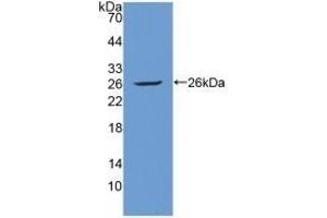 Detection of Recombinant Tie1, Human using Polyclonal Antibody to Tyrosine Kinase With Immunoglobulin Like And EGF Like Domains Protein 1 (Tie1) (TIE1 antibody  (AA 701-898))