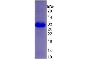Image no. 1 for Eukaryotic Translation Initiation Factor 2-alpha Kinase 2 (EIF2AK2) (AA 224-502) (Active) protein (His tag) (ABIN6239876) (EIF2AK2 Protein (AA 224-502) (His tag))