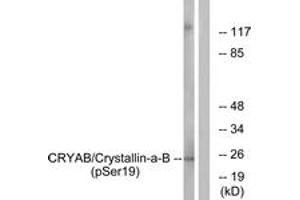 Western blot analysis of extracts from HepG2 cells treated with nocodazole 1ug/ml 16h, using CRYAB (Phospho-Ser19) Antibody. (CRYAB antibody  (pSer19))