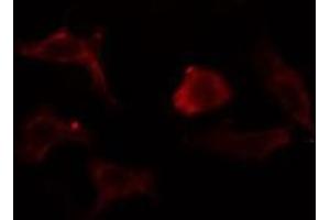 ABIN6275370 staining  Hela cells by IF/ICC.