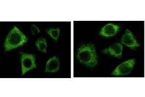 Immunofluorescence staining of methanol-fixed Eca-109 (left) and HepG2 (right) cells showing cytoplasmic localization. (pan Keratin antibody)