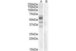 Western Blotting (WB) image for anti-Arylsulfatase D (ARSD) (AA 108-120) antibody (ABIN343011)