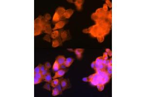 Immunofluorescence analysis of Hep G2 cells using C3 Rabbit mAb (ABIN1680027, ABIN3018233, ABIN3018234 and ABIN7101584) at dilution of 1:100 (40x lens). (AKR1C3 antibody)