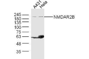 Lane 1: A431 lysates Lane 2: Hela lysates probed with NMDAR2B Polyclonal Antibody, Unconjugated  at 1:300 dilution and 4˚C overnight incubation. (GRIN2B antibody  (AA 451-550))