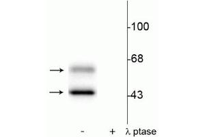 Western blot of rat brain lysate showing specific immunolabeling of the ~50 kDa α- and the ~60 kDa β-CaM Kinase II phosphorylated at Thr286 in the first lane (-). (CaMKII alpha/beta (pThr286) antibody)