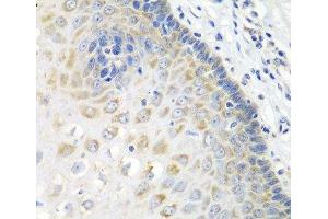 Immunohistochemistry of paraffin-embedded Human esophagus using STXBP4 Polyclonal Antibody at dilution of 1:100 (40x lens). (STXBP4 antibody)