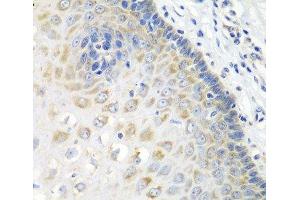 Immunohistochemistry of paraffin-embedded Human esophagus using STXBP4 Polyclonal Antibody at dilution of 1:100 (40x lens). (STXBP4 antibody)