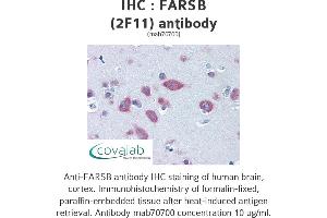 Image no. 3 for anti-Phenylalanyl-tRNA Synthetase, beta Subunit (FARSB) (AA 234-342) antibody (ABIN1723557) (FARSB antibody  (AA 234-342))