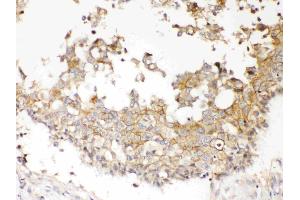 IHC analysis of NDRG3 using anti- NDRG3 antibody .