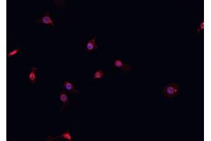 ABIN6267056 staining A-431 cells by IF/ICC. (Cyclin D1 antibody  (C-Term))